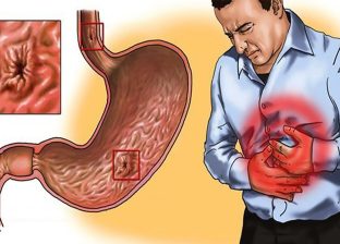 दशैंमा ग्यास्ट्रिकका बिरामीहरुले के खाने, के नखाने ?