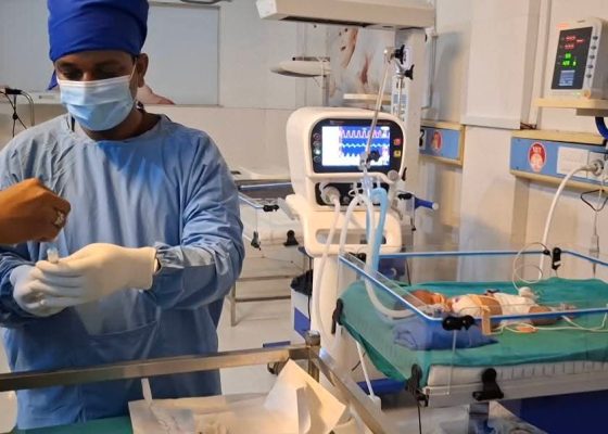 चन्द्रपुर अस्पतालमा पहिलो पटक नवजात शिशुको फोक्सोको जटिल उपचार सफल