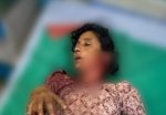 बाघको आक्रमणबाट एक महिला घाइते