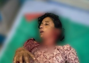 बाघको आक्रमणबाट एक महिला घाइते बाघको आक्रमणबाट एक महिला घाइते